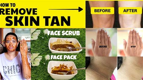 Effective Way To Remove Tan From Facehandsneck And Legs