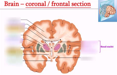 Neuroanatomy Coronal Section Of Brain Diagram Quizlet
