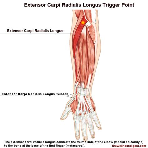 Extensor Carpi Radialis Longus Muscle Pain The Wellness Digest