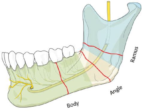 The Image Would Show The Locations Of Injury Of Inferior Alveolar