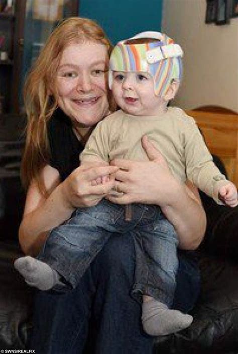 Kind Stranger Transforms The Life Of Baby Born With Flat Head Syndrome
