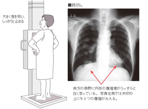 We did not find results for: 胸部単純X線撮影検査とは｜病気の検査法を調べる - 医療総合QLife