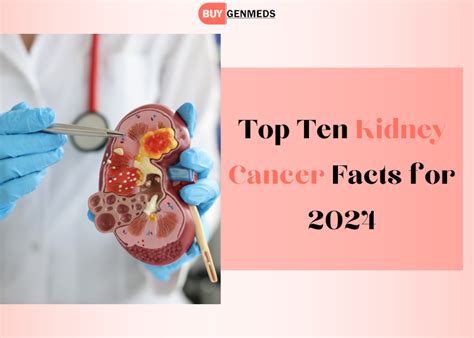 Top Ten Kidney Cancer Facts For 2024