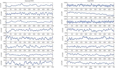 Figure 4 From Automatic Seizure Detection In Multichannel Eeg Using
