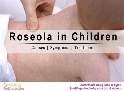 Roseola Rash In Babies Skin Rashes In Children On Face In Adults On