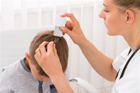 Top 10 Best Lice Treatment For Kids And Reviews In 2024