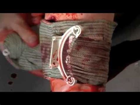 Welcome to israeli first aid. Israeli Bandage II - YouTube