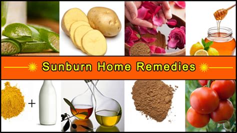 10 Simple Sunburn Home Remedies That Magically Works