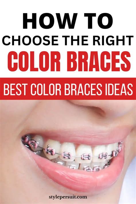Braces Colors Ideas How To Choose The Right Color Braces Stylepersuit