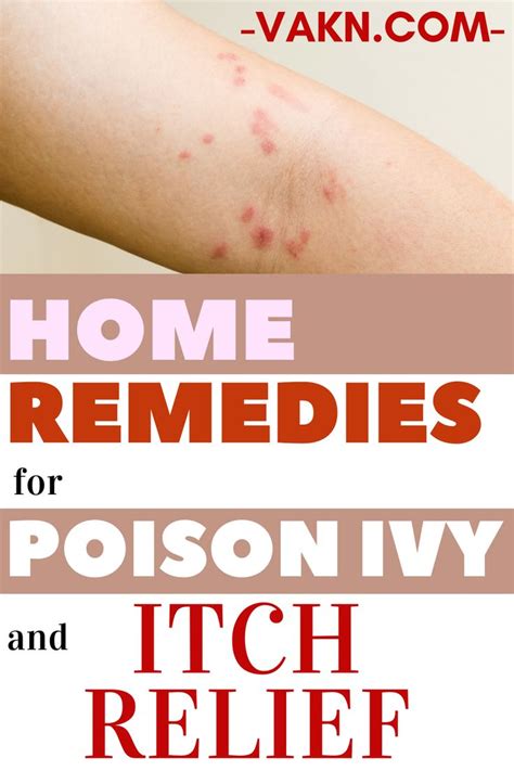 Home Remedies For Poison Ivy Rash And Itch Relief Poison Ivy Remedies Poison Ivy Rash Poison