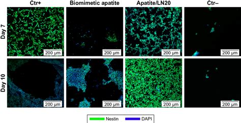 Immunofluorescence Images Of Nestin A Nsc Marker Green And Dapi