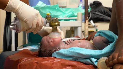 Helping Babies Breathe At Birth Newborn Care Series Youtube