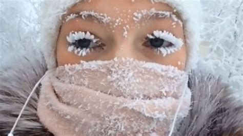 Frozen Eyelashes Girl From Russia Shares New Summer Problem
