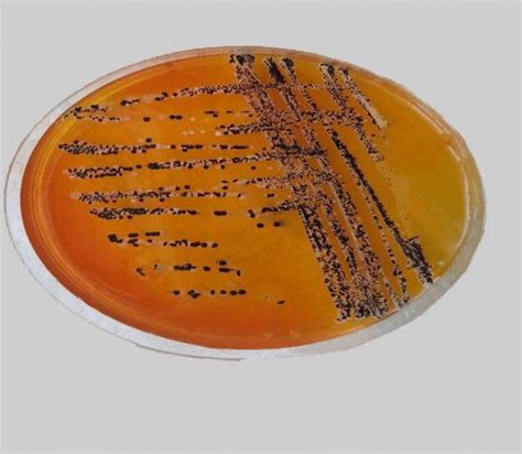 Examine he, xld, and bs plates for presence of colonies xld typical salmonella appear as opaque/yellow, pink, or red colonies with black centers. shows isolation Salmonella .Entertites on XLD agar ...