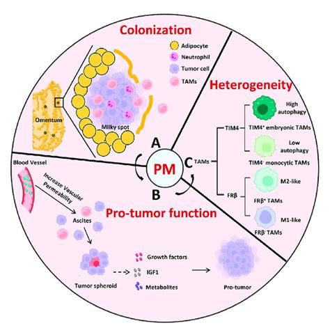 The Role Of Peritoneal Resident Macrophages In The Tumor Metastasis