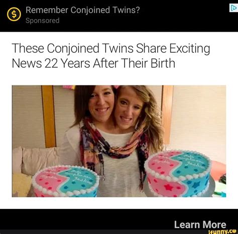 remember conjoined twins sponsored these conjoined twins share exciting news 22 years after