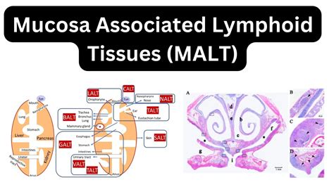 Mucosa Associated Lymphoid Tissues Malt