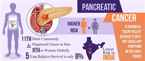 Pancreatic Cancer All The Disease Its Diagnosis And Management