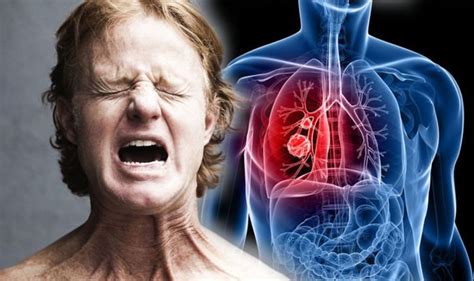 Lung Cancer If You Feel A Pain In These Body Parts It Could Be An