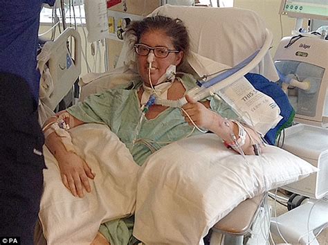 Doctors Save Woman S Life By Removing Her Lungs For Days Daily Mail