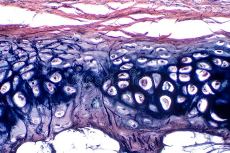 Hyaline Cartilage Tissue Under Microscope