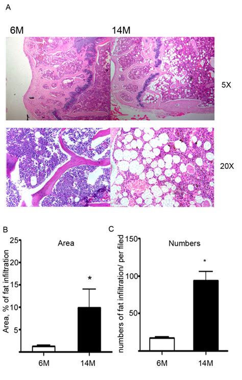 Quantitative Analysis Of Bone Marrow Adipocytes A The Top Panels Are