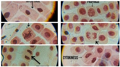 Because of the rapid rate at which onion root tips grow as a result of rapid cell division, it's possible to observe and identify the different stages of. Onion root tip mitosis experiment - YouTube