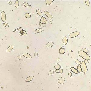 Беспуриновая диета что