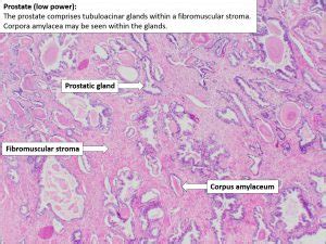 Prostate Normal Histology NUS Pathweb NUS Pathweb