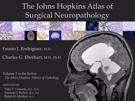 Neuropathology Blog Screenshots Of The Surgical Neuropathology Volume