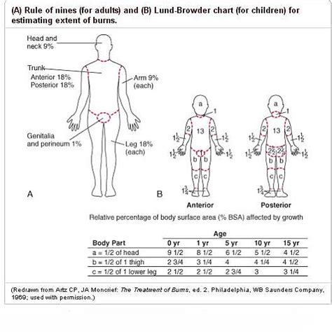 Emergency Medicine Educationpediatric Trauma Pearls And