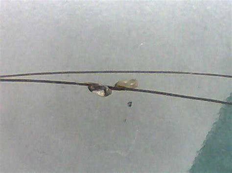 しらみ（頭シラミ） の 簡単な見つけ方 ( 子どもの病気 ...