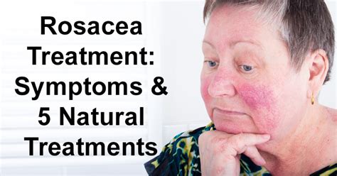 Rosacea Treatment Symptoms And 5 Natural Treatments David Avocado Wolfe