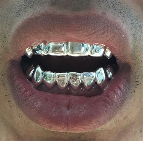 Find gold teeth usa at 3015 nw 79th st, miami, fl. Gold Grillz Miami