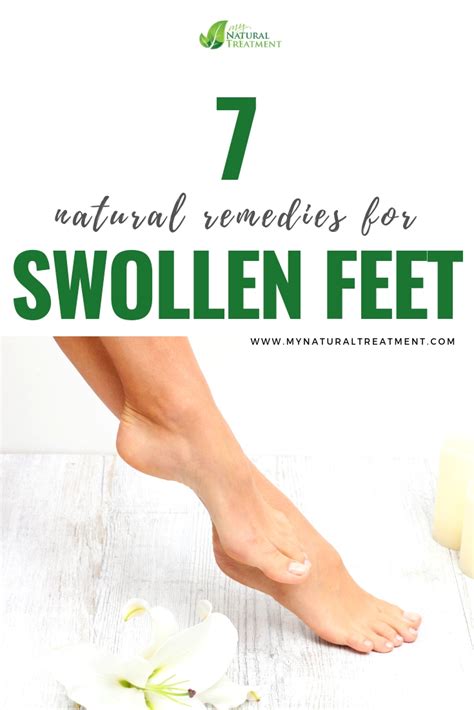 7 Natural Remedies For Swollen Feet Swollen Feet Swelling Feet Foot
