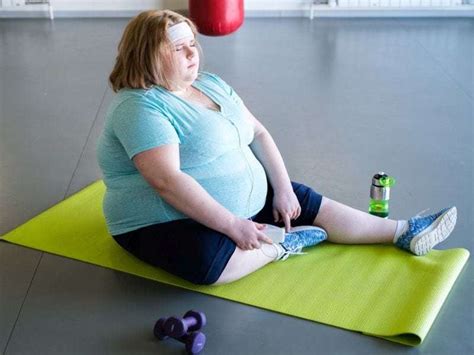 Obesity Tied To Increased Risk For Early Onset Crc In Women