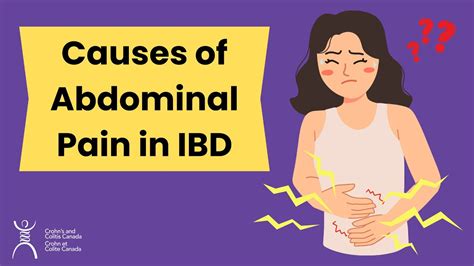 Causes Of Abdominal Pain In Ibd Youtube