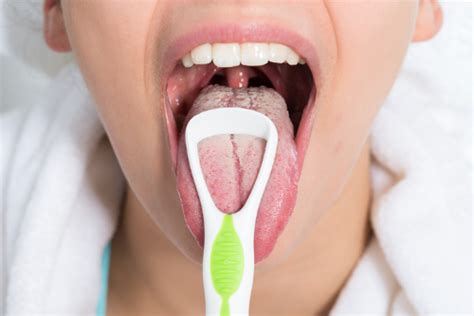 White Tongue 10 Causes And Natural Remedies