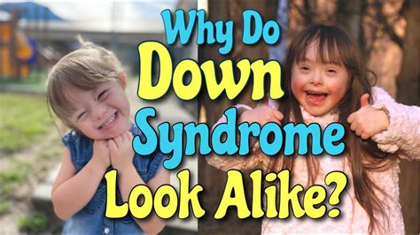 why do down syndrome people look alike updated youtube