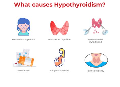 Understanding Thyroid Problems Causes Symptoms And Treatment Dr Lal