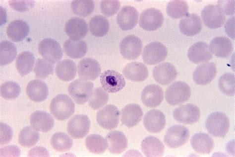 Free Picture Magnified X Photomicrograph Presence Plasmodium