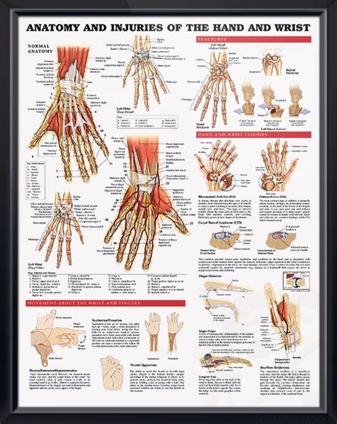 Anatomy And Injuries Of The Hand And Wrist Anatomical Chart Anatomical