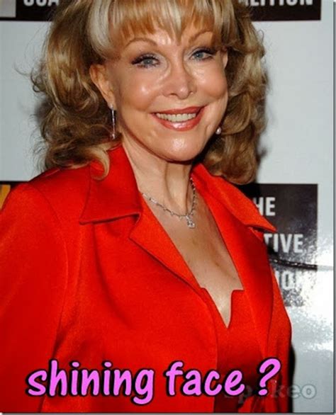 Barbara Eden Faceliftnose Jobs And Breast Implants Plastic Surgery