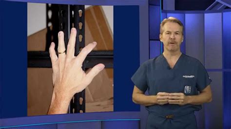 Jimmy Fallon Finger Injury Ring Avulsion Youtube