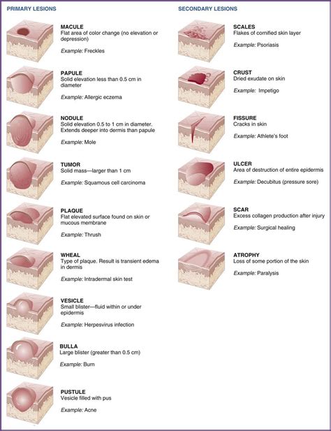 Pin By Doctor Medicine On Dermatology Types Of Skin Rashes Skin