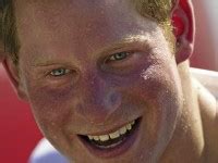 Nude Photos Of Prince Harry Are Genuinepalace Inquirer Entertainment