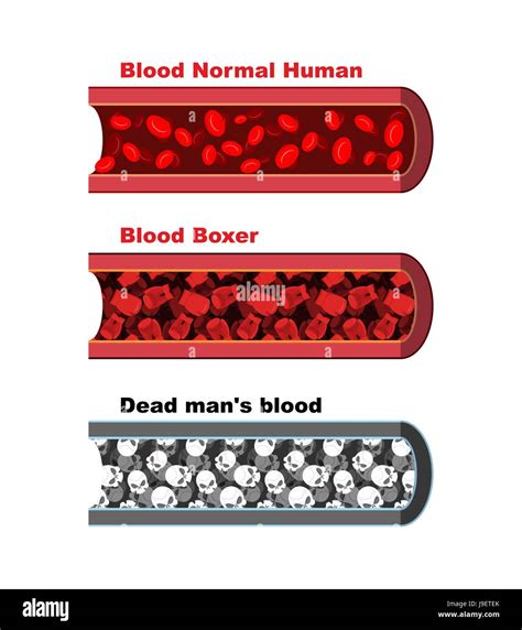 Blood Vessel Flow Chart