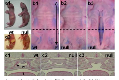 Figure 1 From Tbx22null Mice Have A Submucous Cleft Palate Due To