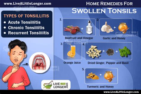 Herbal Remedies For Tonsillitis