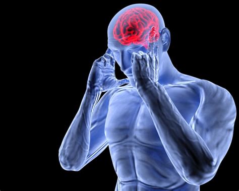 What Type Of Headache You Have Based On Its Location
